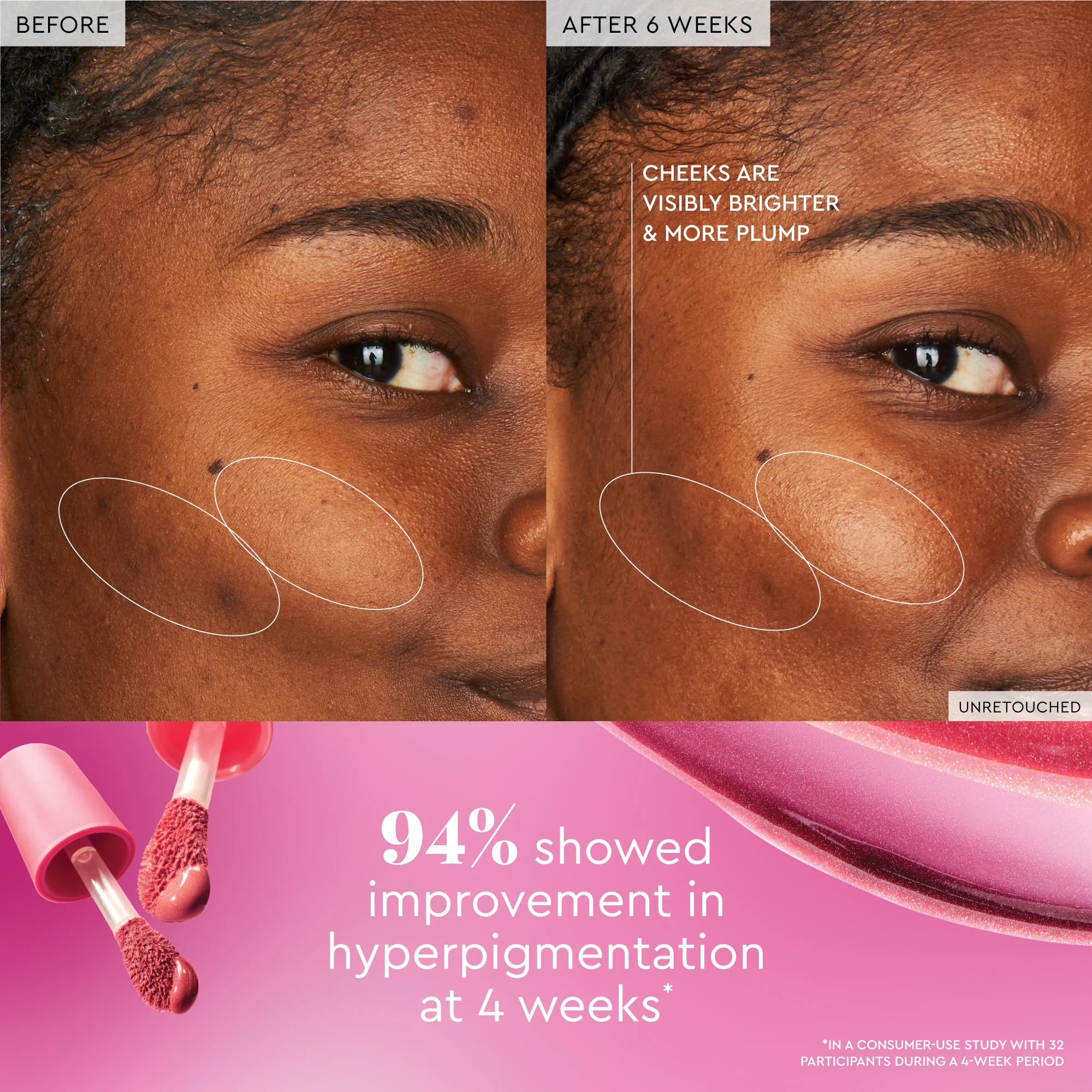 18-watermelon-glow-niacinamide-dewy-flush-22.webp Watermelon Glow Niacinamide Dewy Flush