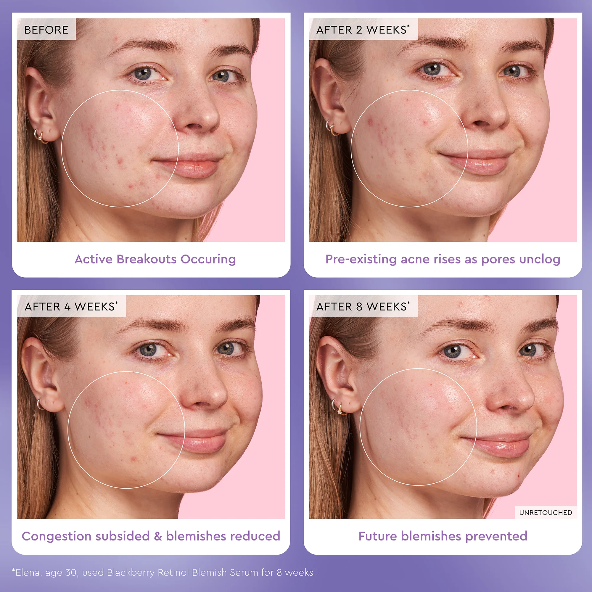 33-blackberry-retinol-blemish-serum-4.webp Blackberry Retinol Blemish Serum