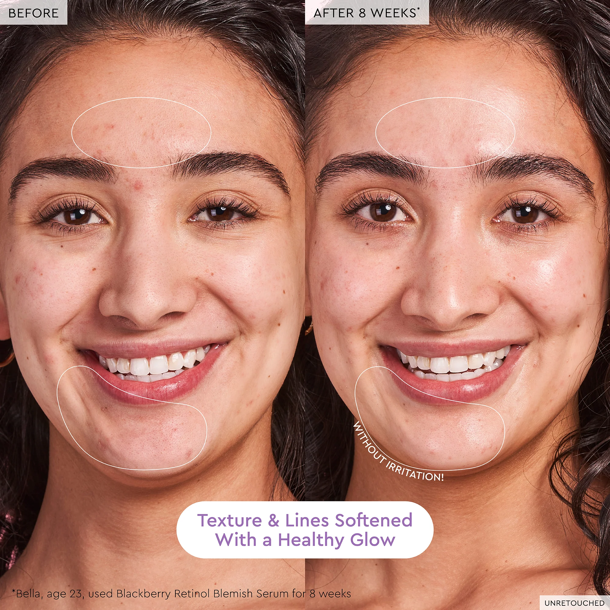 33-blackberry-retinol-blemish-serum-6.webp Blackberry Retinol Blemish Serum
