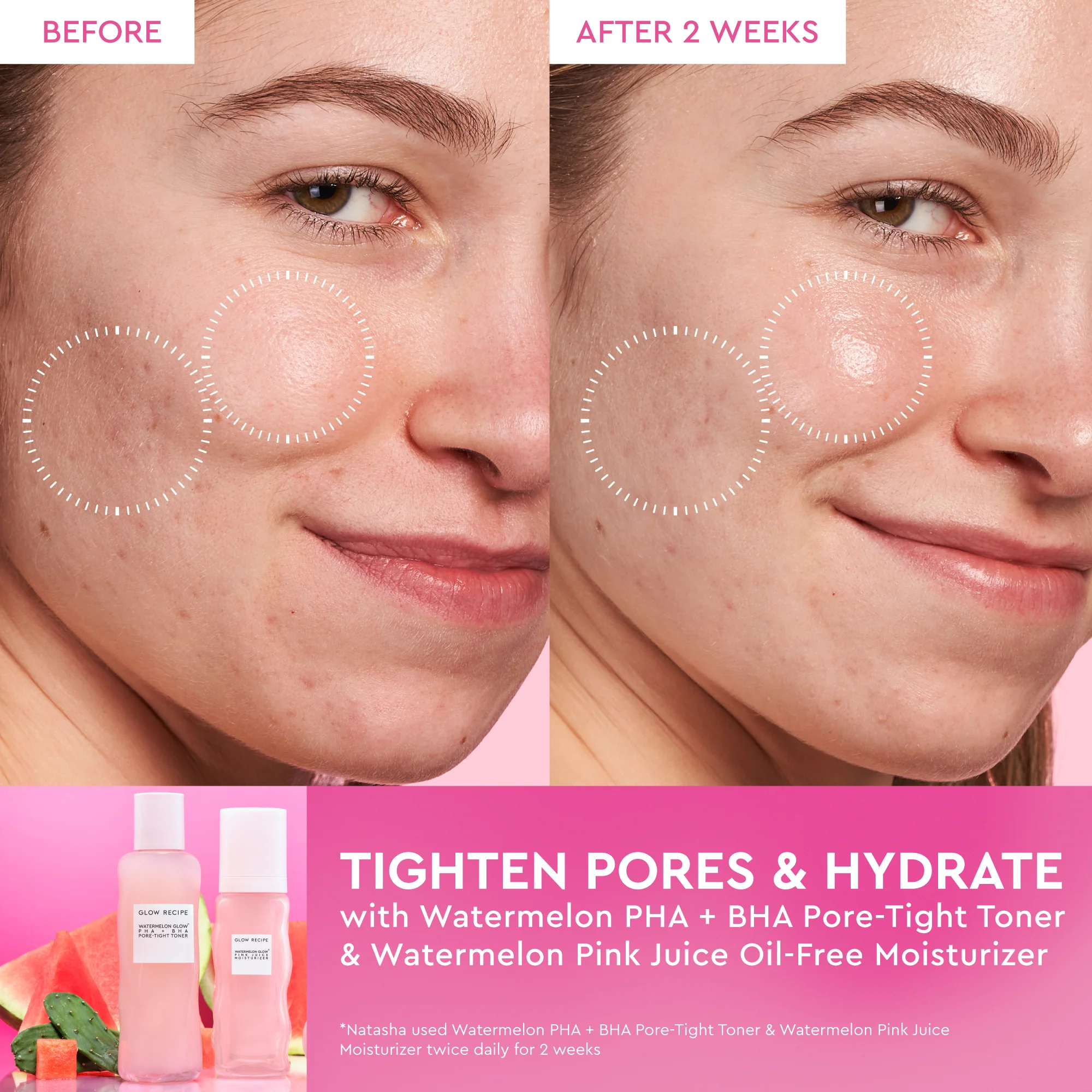 44-watermelon-glow-dewy-skin-routine-6.webp Watermelon Glow Dewy Skin Routine