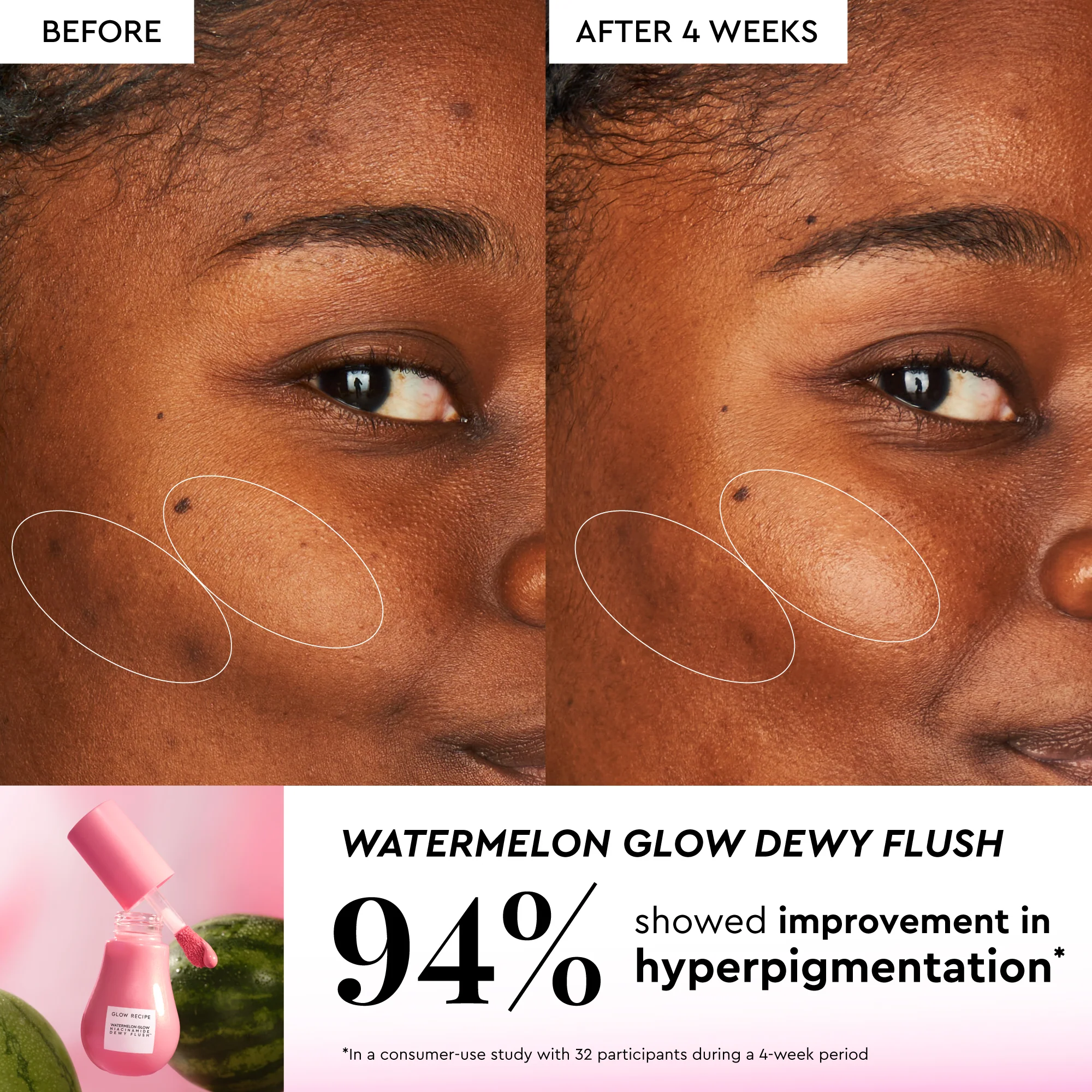 70-watermelon-glow-best-sellers-kit-7.webp Watermelon Glow Best-Sellers Kit